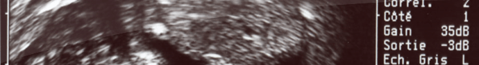 Les échographies